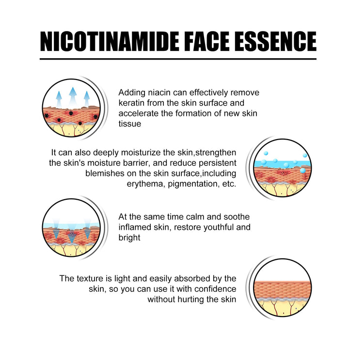 Niacinamide Face Essence for Acne Marks & Pores