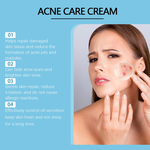 Acne Repair Cream for Closed Comedones & Acne Scars
