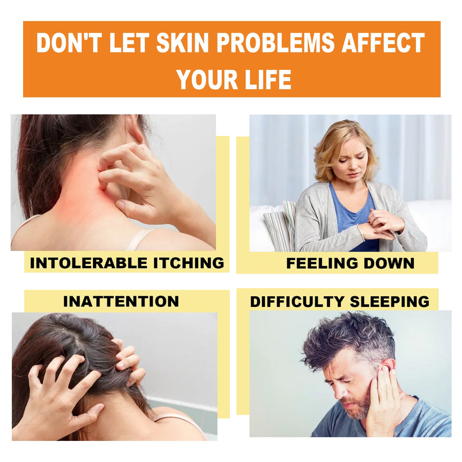 Bee Venom Psoriasis Cream, Relieve Itchy Skin Repair Hand Mo