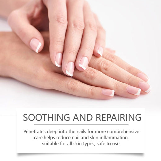 Tea Tree Nail Oil for Yellow, Fungal-Prone Nails