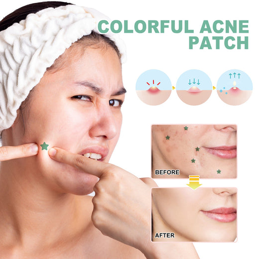 Acne Patches — Fast, Gentle Coverage For Breakout Days