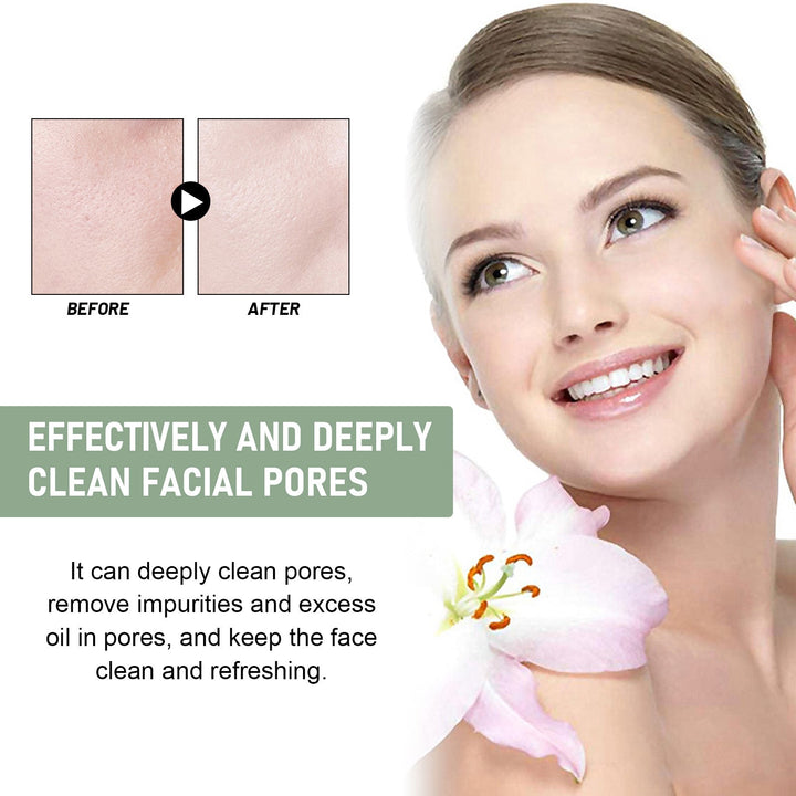 Houttuynia Pore Cleansing Foam for Oily Acne-Prone Skin