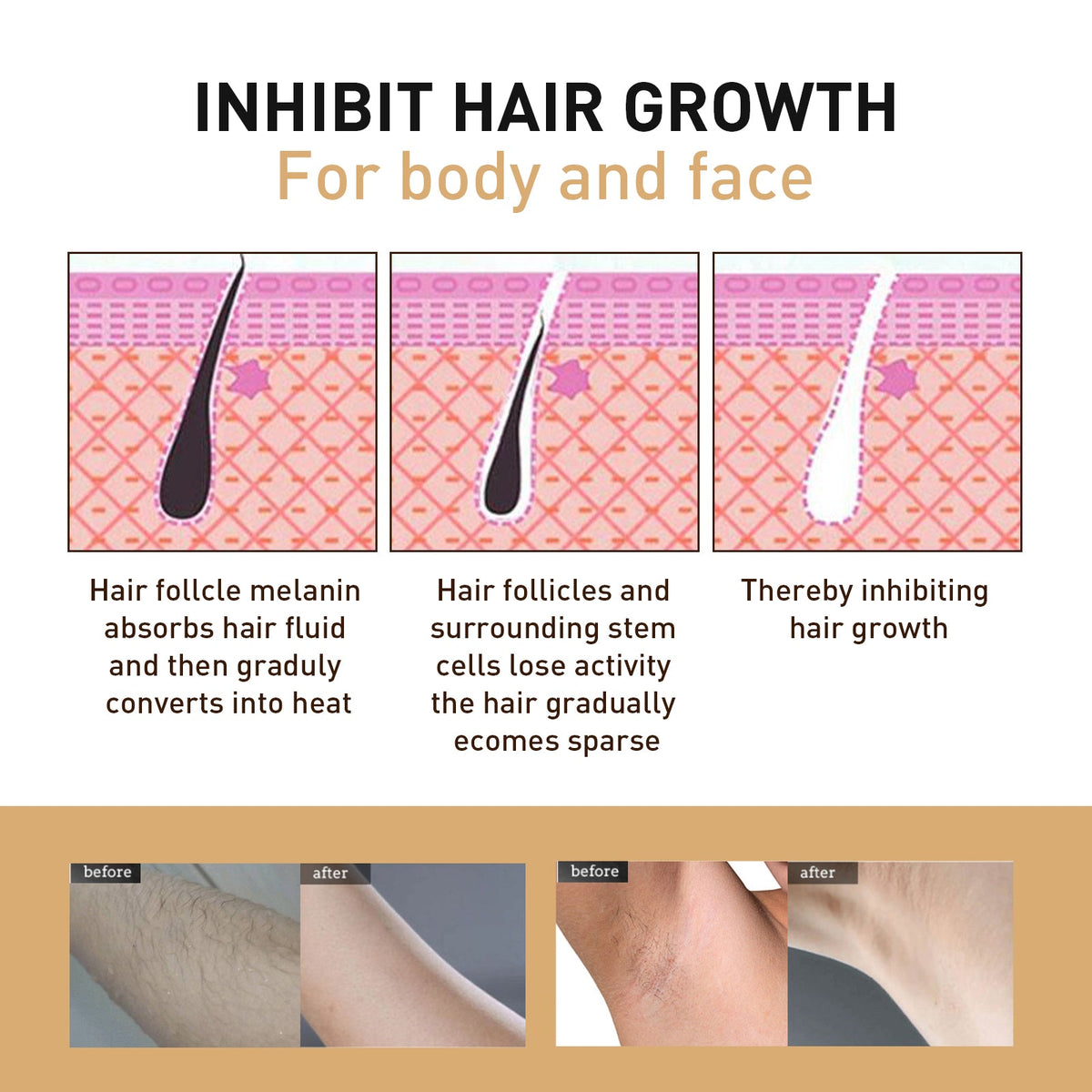 Hair Removal Spray for Silky Smooth Skin Fast