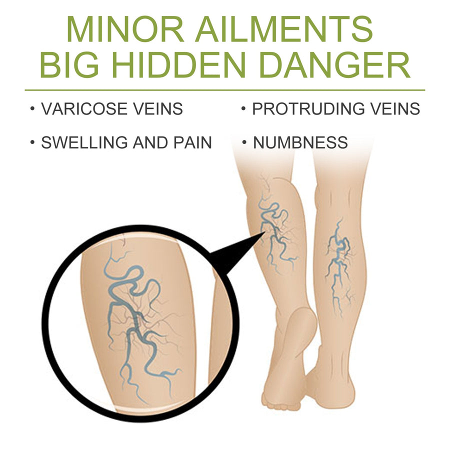 Vein Fading Cream — Visibly Reduce Vein Appearance & Leg