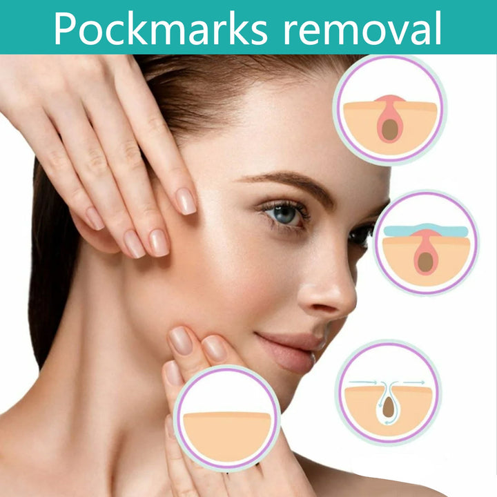 0.5mm Micro-Needle Face Roller for Acne Scars & Lines