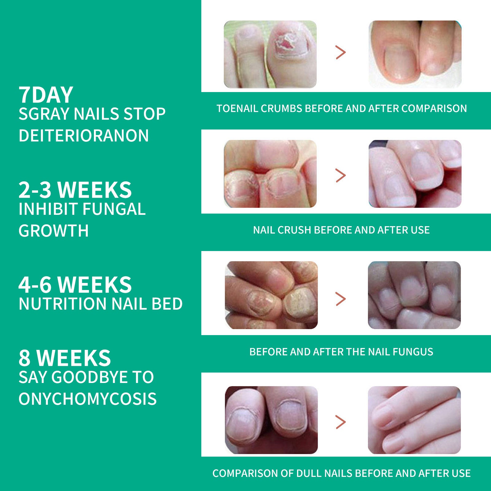 Timeline progression chart with teal background showing 8-week results: 7 DAY SGRAY NAILS STOP DETERIORATION, 2-3 WEEKS INHIBIT FUNGAL GROWTH, 4-6 WEEKS NUTRITION NAIL BED, 8 WEEKS SAY GOODBYE TO ONYCHOMYCOSIS. Four before/after comparison pairs showing toe nail crumbs clearing, nail crush recovery, fungal nail healing, and dull nail brightening