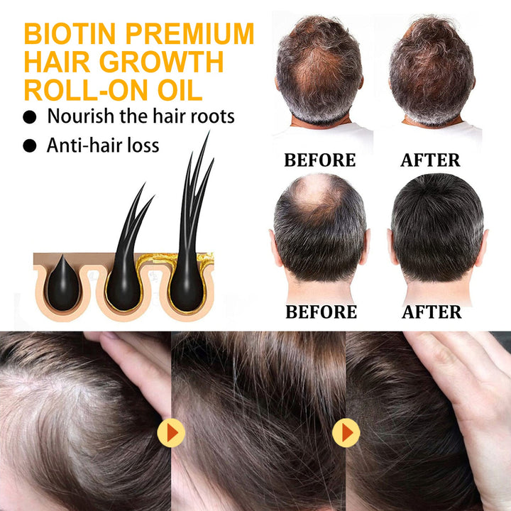 Biotin Hair Oil Roll-On for Fuller-Looking, Shinier Hair