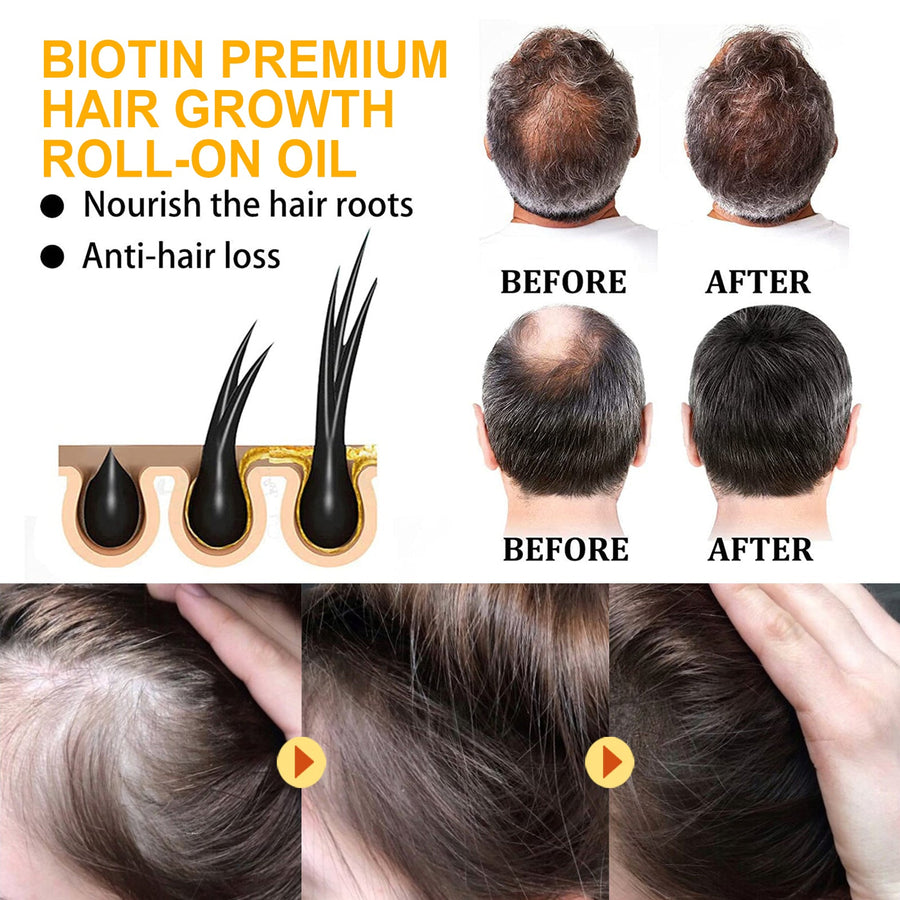 Biotin Hair Oil Roll-On for Fuller-Looking, Shinier Hair