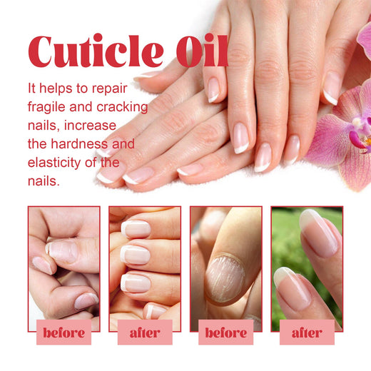 Herbal Cuticle Oil for Brittle, Cracking Nails Repair