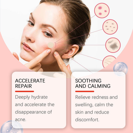 Invisible Acne Patches That Visibly Shrink Blemishes Overnight