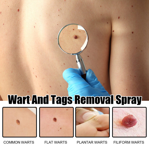 Skin Tag & Blemish Spray with Bee Venom Complex