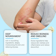 OceAura Advanced Antifungal Cream product box and jar displaying brand identity, claims, and 30G/1OZ volume