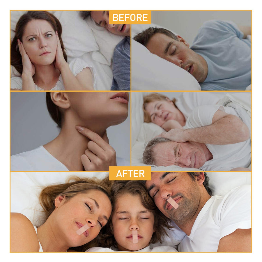 Anti‑Snoring Mouth Tape – Drug‑Free Snore Strips for Quiet Sleep