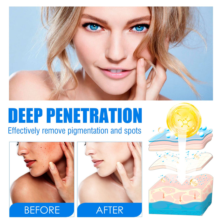 Melasma Spot Cream for Dark Spots & Uneven Tone