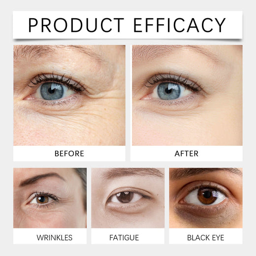Eye Cream For Eyebags, Mild Skin Lotion To Reduce Puffy