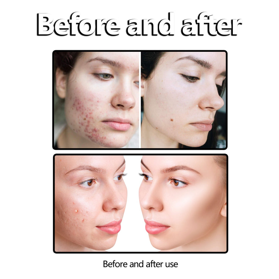 Jasmine Rice Facial Cleanser for Sensitive, Blemish-Prone Skin