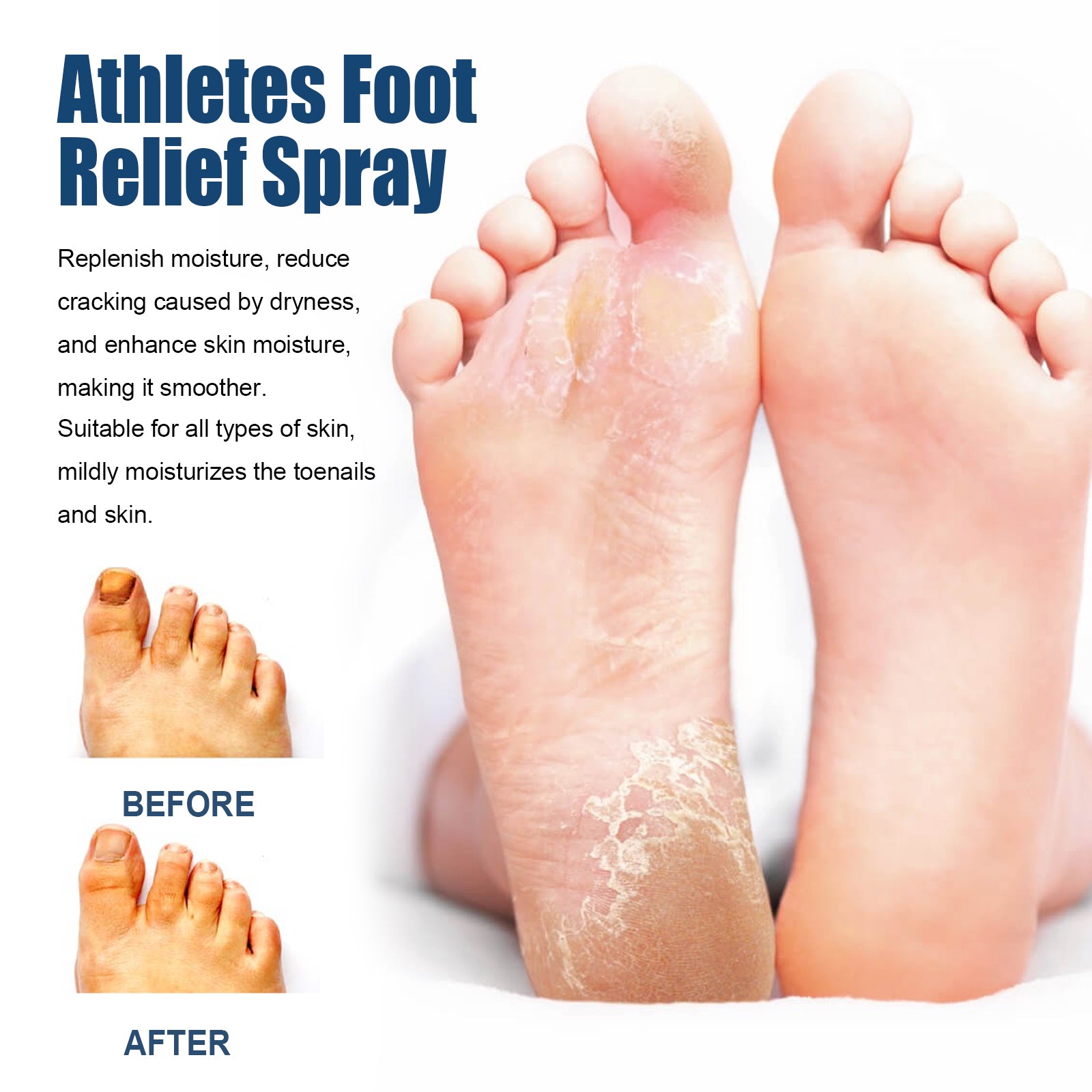 Large-scale before/after showing cracked, peeling feet with severe dryness versus smooth, moisturized, healthy-looking feet