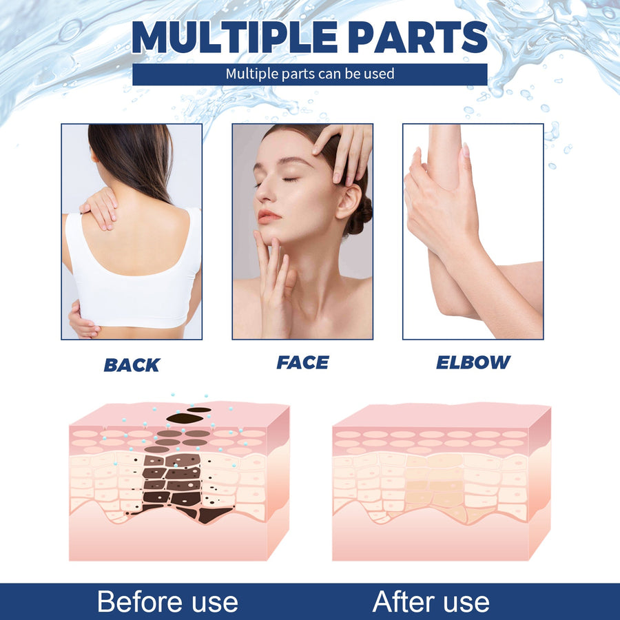 Spot Body Cleanser for Face, Freckles & Uneven Tone