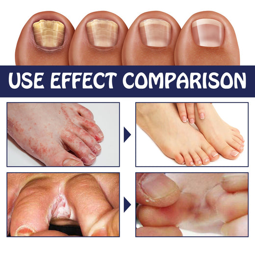 Herbal Foot Soak Sachets for Pain, Odor & Nail Relief