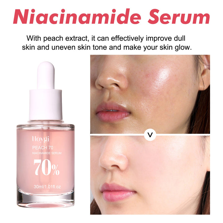 Niacinamide 70% Serum for Pores, Spots & Dull Skin