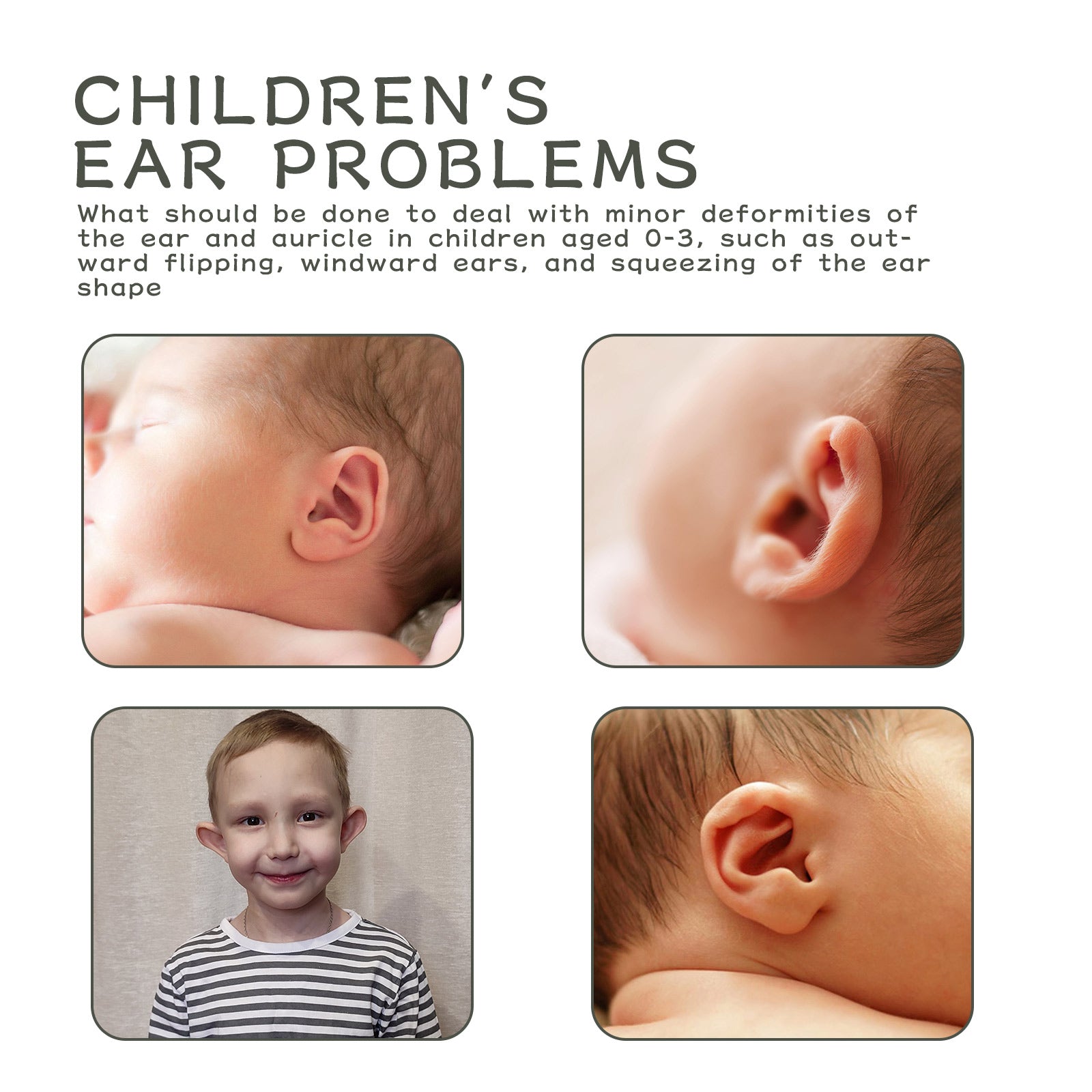 Split-screen comparison showing infant ear before (flared outward) and after (naturally aligned), plus lifestyle image of baby wearing patch and holding product roll
