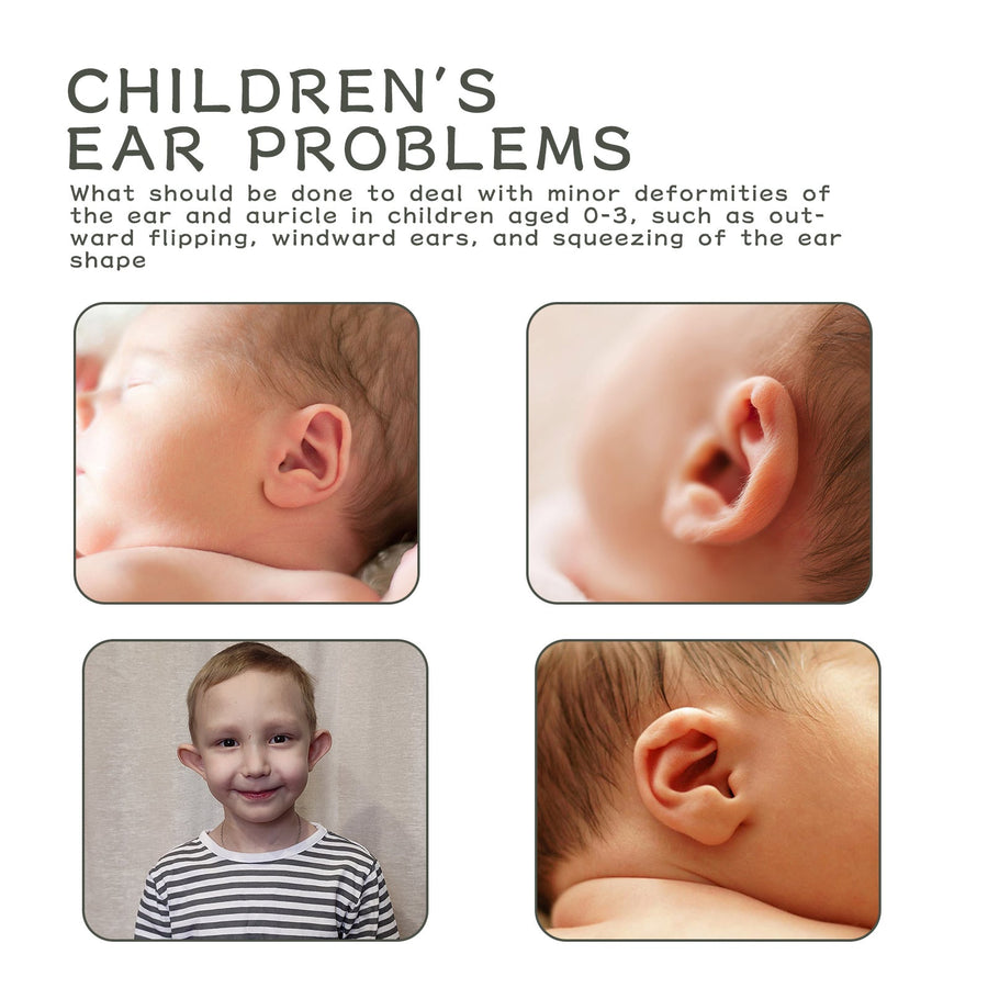 Silicone Ear Correction Patch for Infants — Gentle