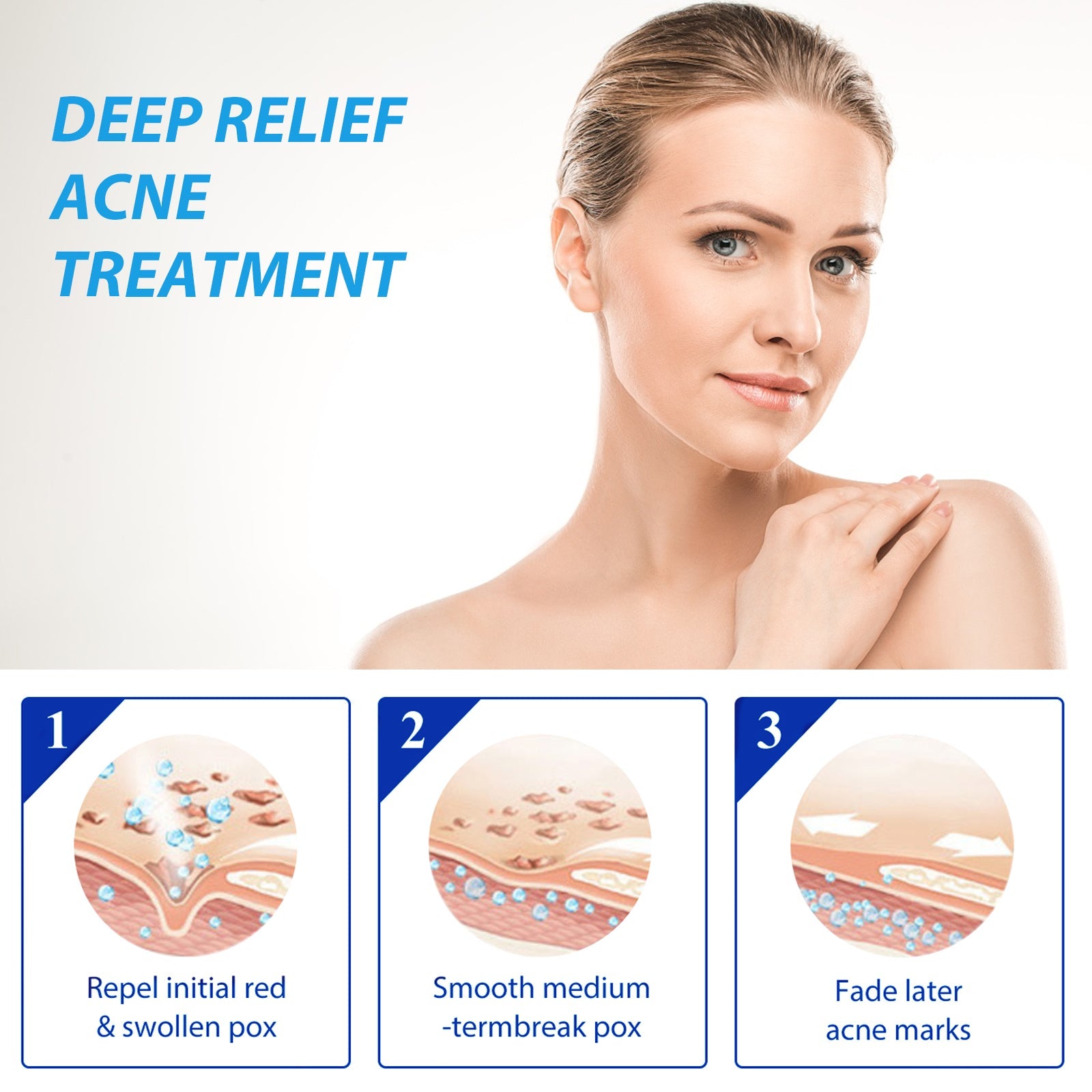 Split-screen before/after of acne-prone skin showing dramatic improvement from left (clustered red pimples) to right (clear skin)