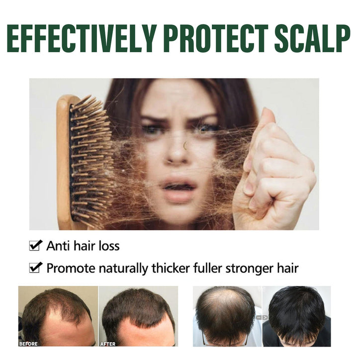Amla Anti-Thinning Shampoo for Fuller-Looking Hair