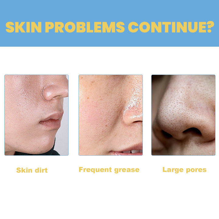 Oligopeptide Bubble Cleansing Essence for Pore Tightening