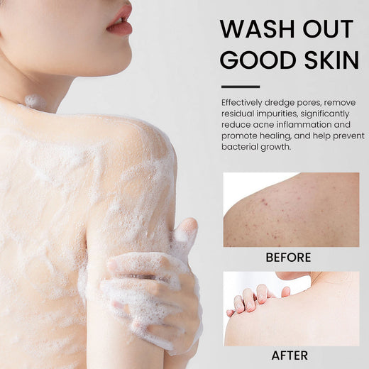 Carbon Clay Back Soap for Body Acne & Dark Spots