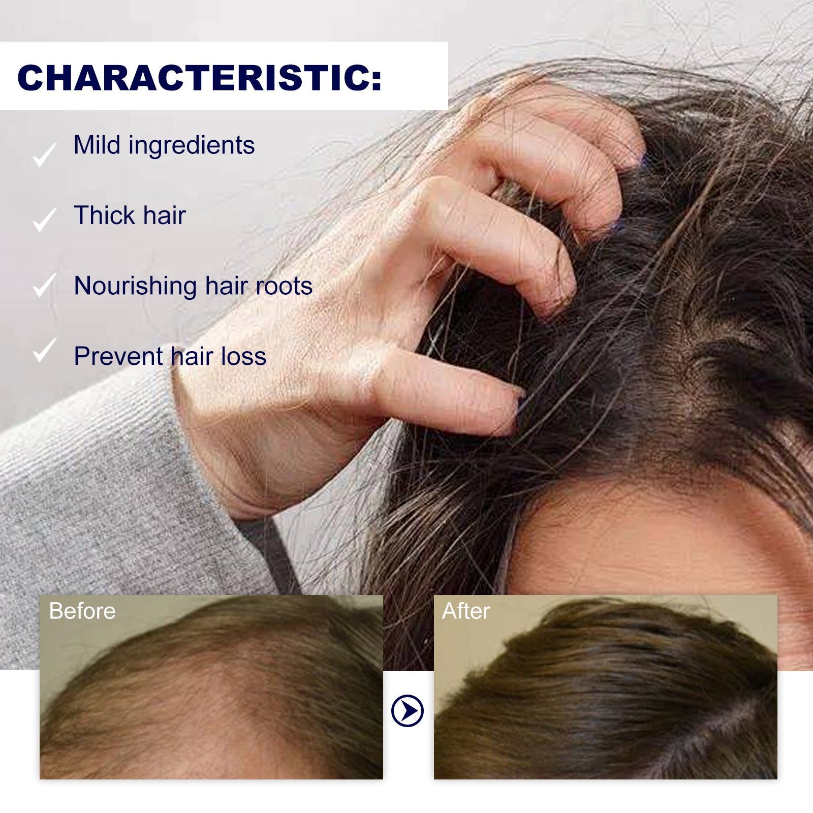 Split image showing characteristic benefits with hand holding thick hair on one side, before/after scalp photos below demonstrating reduced thinning, and checklist of product characteristics