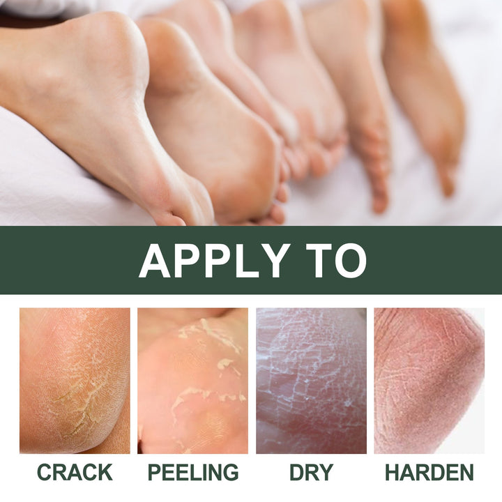 Cracked Heel Cream for Softer Hands, Feet & Calluses