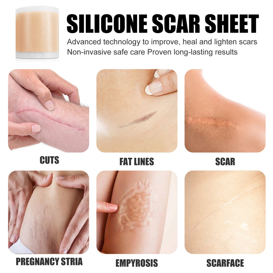 Silicone Scar Treatment — Cut-to-Fit Smoother-Looking Care