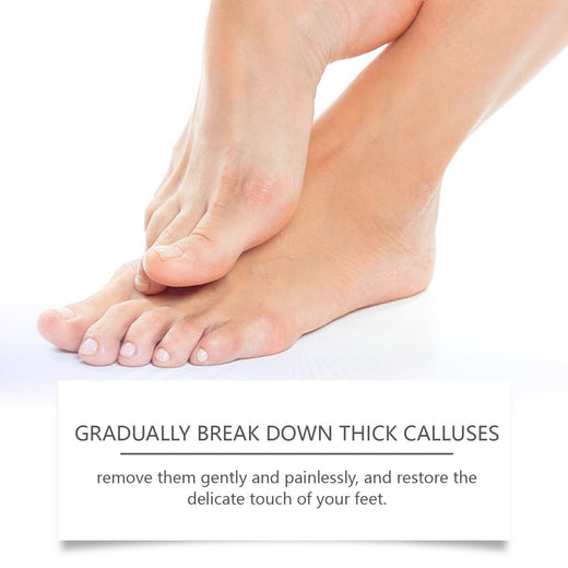 Foot Callus Removal Cream for Soft, Crack-Free Heels