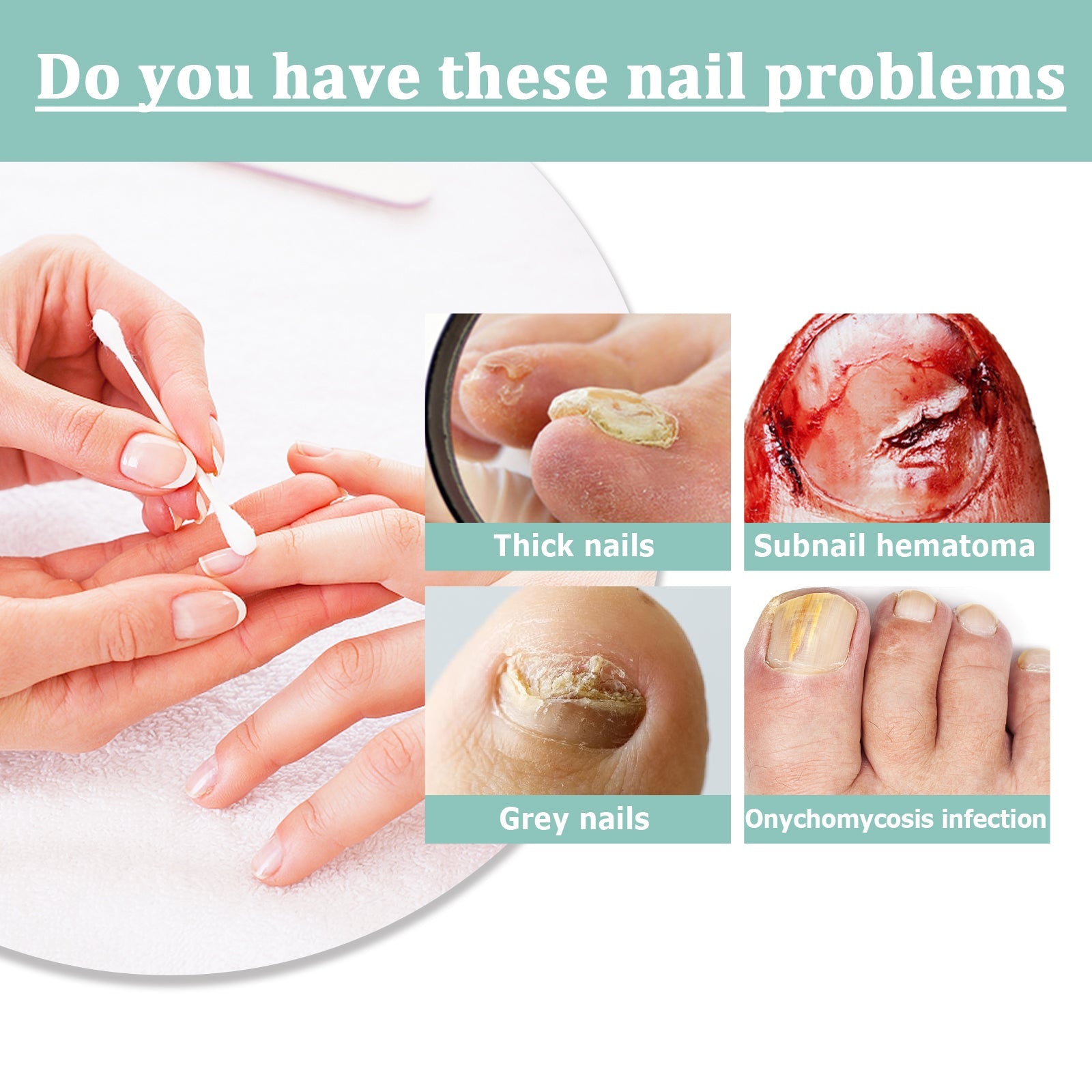Split-screen comparison showing unhealthy nail with visible damage/fungus on left transitioning to healthy, clear nail on right with product and box