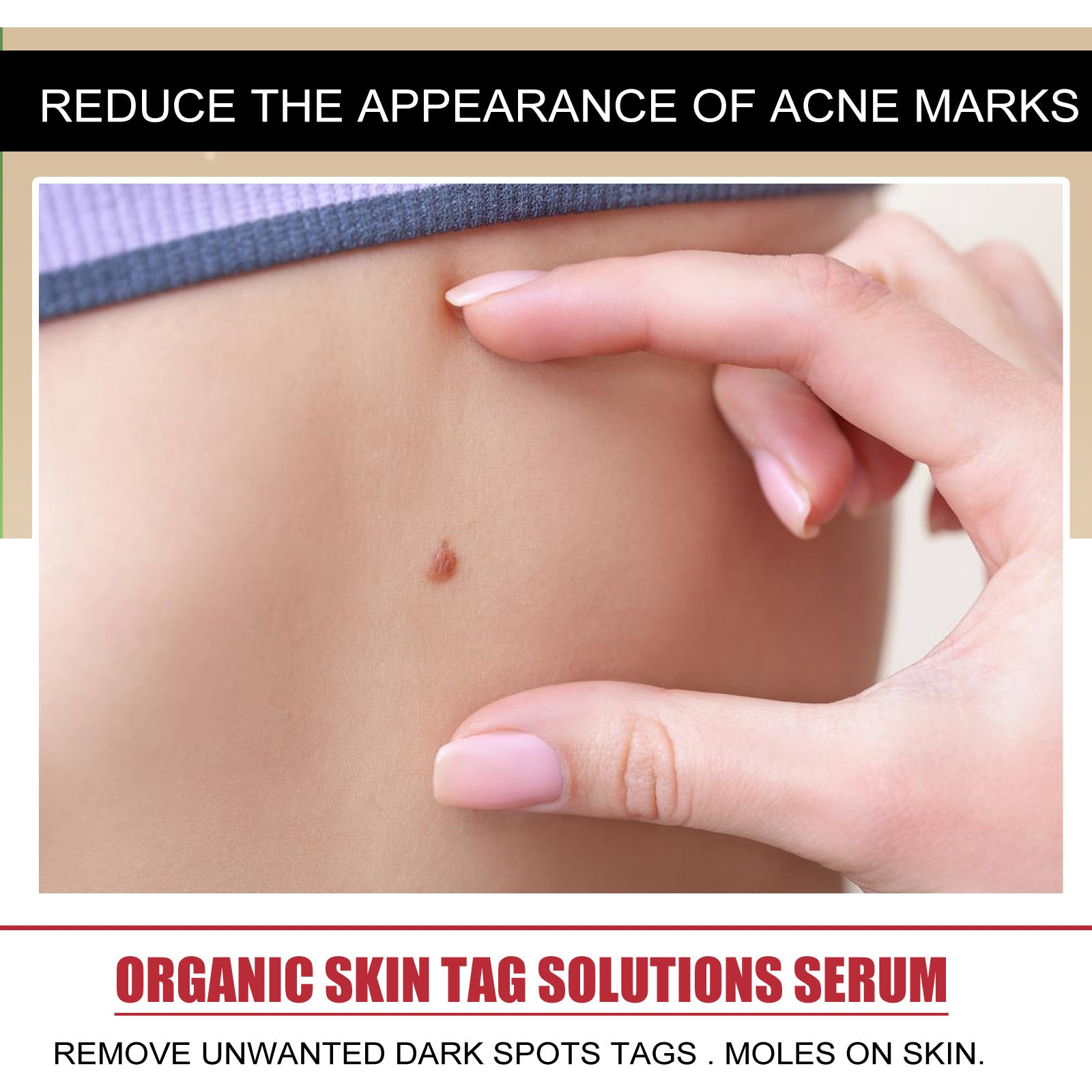 Detailed skin examination showing mole and age spot on body with headline 'Reduce the Appearance of Acne Marks'