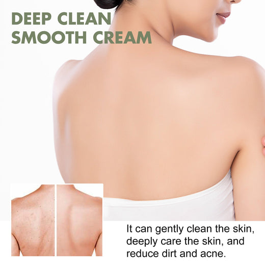 South Moon Body Cream for Keratosis and Dark Spots
