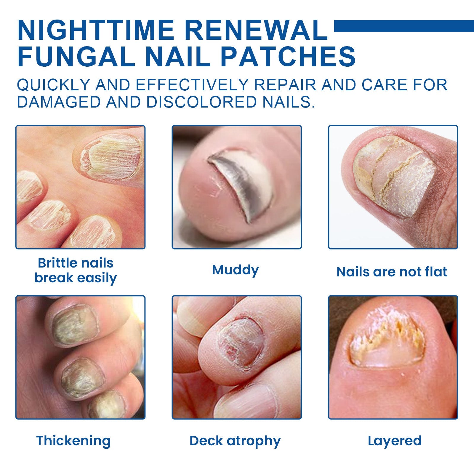 Six-panel condition guide showing brittle nails, muddy discoloration, non-flat nails, thickening, deck atrophy, and layered damage with labels