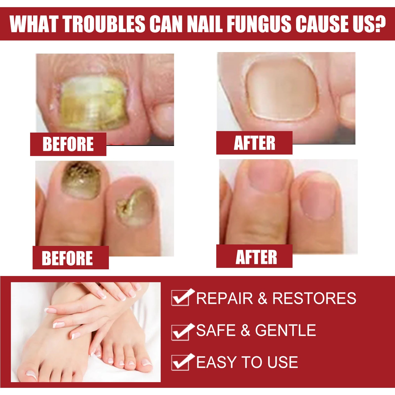 Detailed grid of four before/after nail comparisons: thick yellow fungal nails transforming to clear healthy pink nails; includes foot imagery and checkmarked benefits (Repair & Restores, Safe & Gentle, Easy to Use)