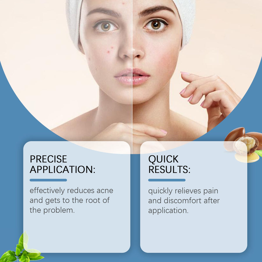 Acne Spot Pen with Precision Pump for Targeted Relief