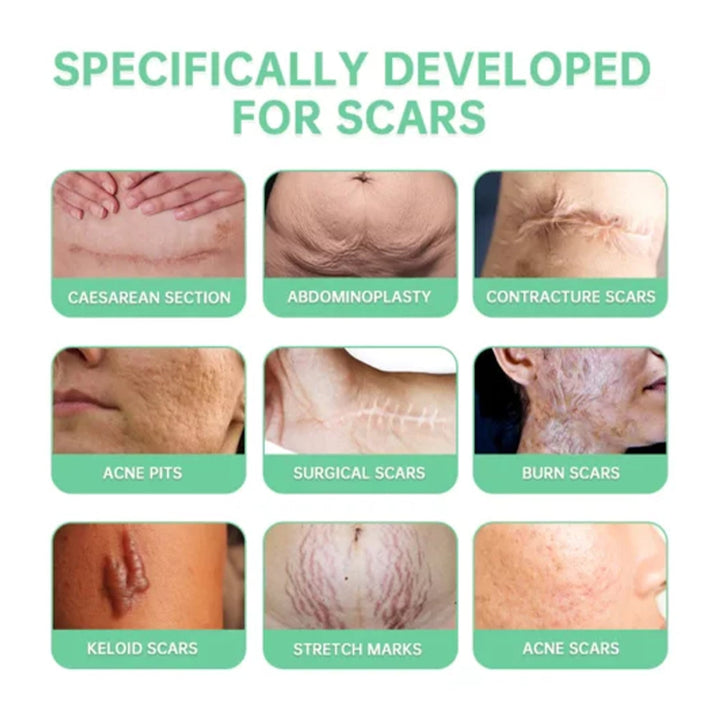 Scar Repair Spray for C-Section, Surgery & Acne Marks