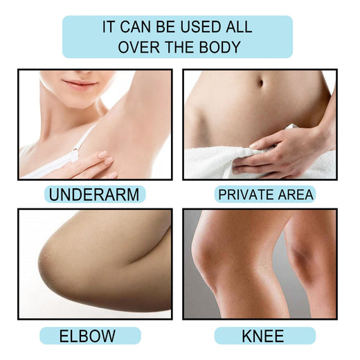 Brightening Body Cream for Dark Elbows, Knees & Underarms