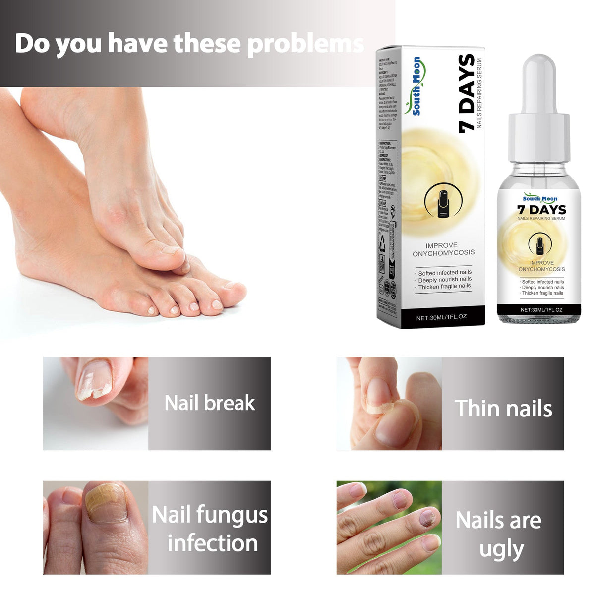 Nails Repairing Serum, Repair Hands And Feet Gray Nails Soft