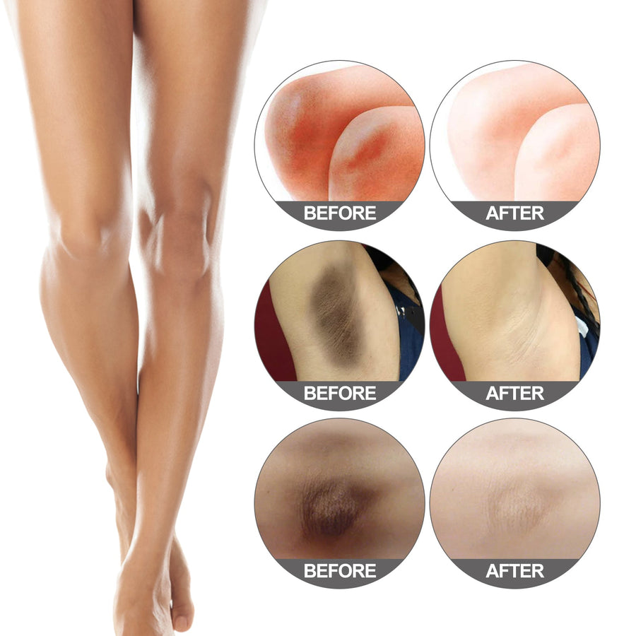 Elbow & Knee Brightening Moisturizer for Even Skin