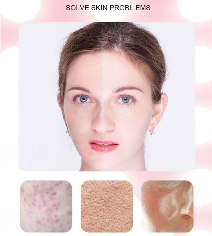 Facial Skin Rejuvenation Device — 5‑in‑1 Anti‑Aging & Acne
