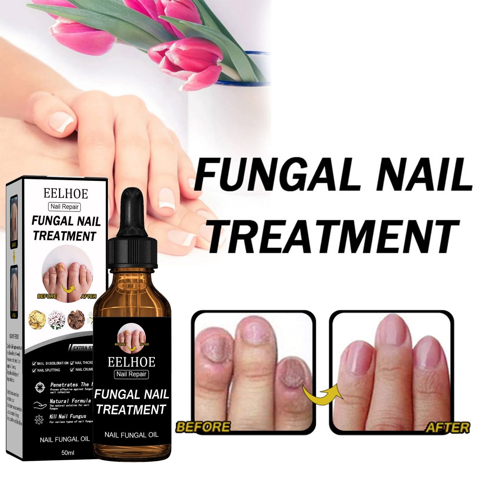 Lifestyle scene with healthy hands holding flowers, showing treated nails and dramatic before/after panels