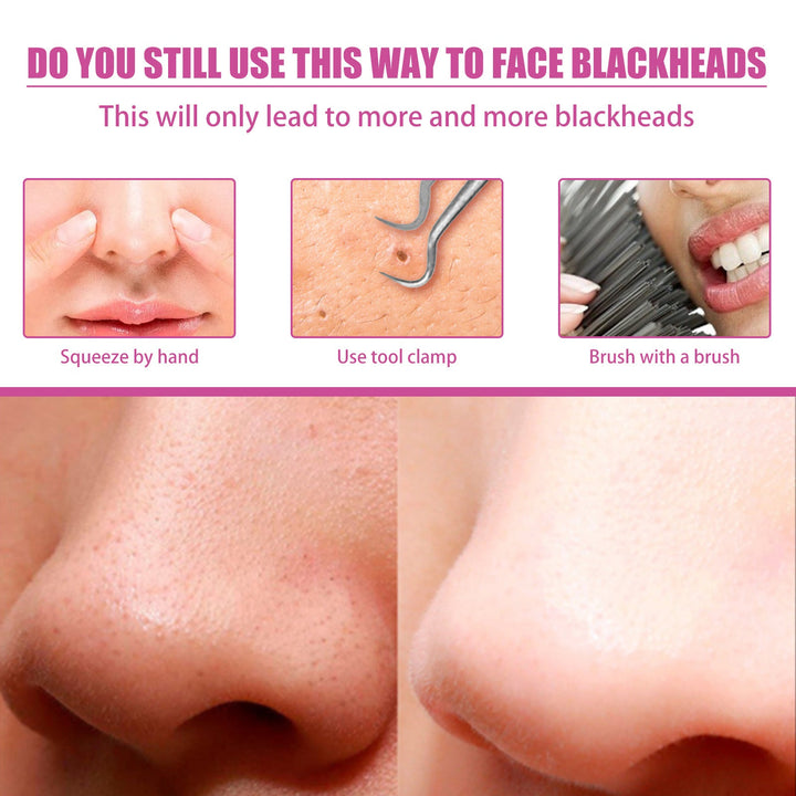 Aloe Vera Blackhead Gel for Clearer-Looking Pores