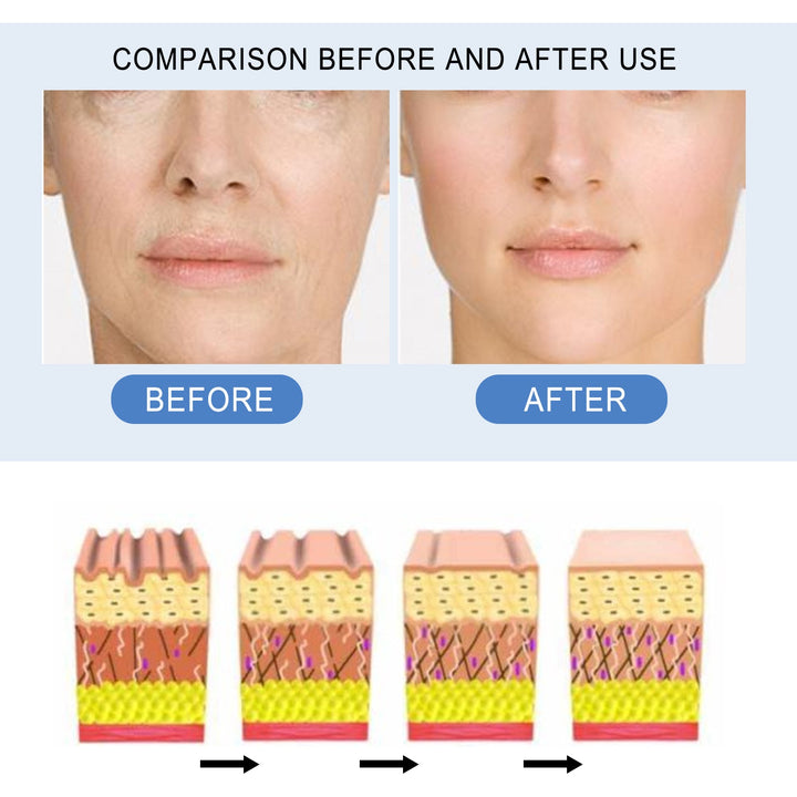 7-Day Ampoule Serum for Dark Spots & Melasma