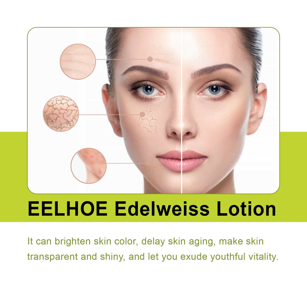 Edelweiss Face Mist Lotion for Brightening & Hydration