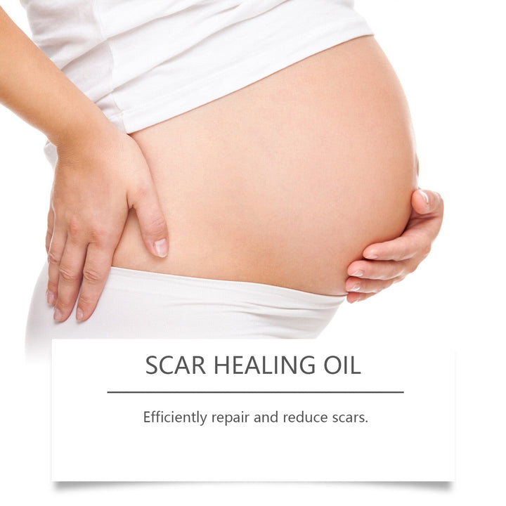 Scar Healing Oil — Visibly Reduce Stretch Marks & Old Scars